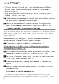 Page 100